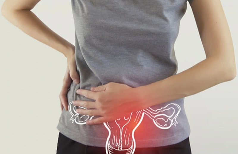 Nút mạch u xơ tử cung là gì? Ưu điểm của phương pháp điều trị này ra sao? 1