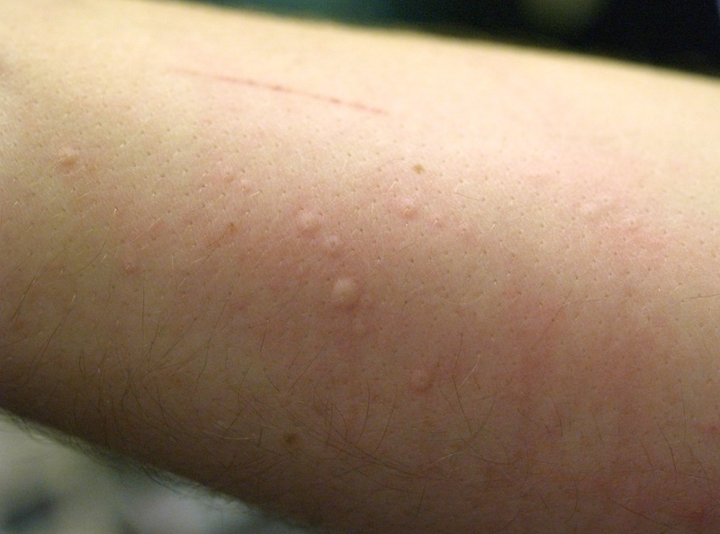 Ốc núi: Thành phần dinh dưỡng và những lợi ích sức khỏe 4