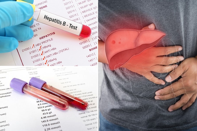 Phân biệt gan nhiễm mỡ do rượu và không do rượu 4