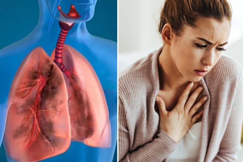 Phổi tắc nghẽn mạn tính giai đoạn 2 là gì? Có chữa được không? 1