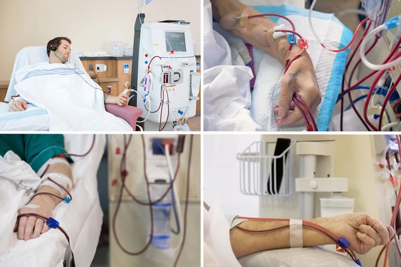 Quy trình chăm sóc bệnh nhân chạy thận nhân tạo tại nhà và những điều cần lưu ý 1