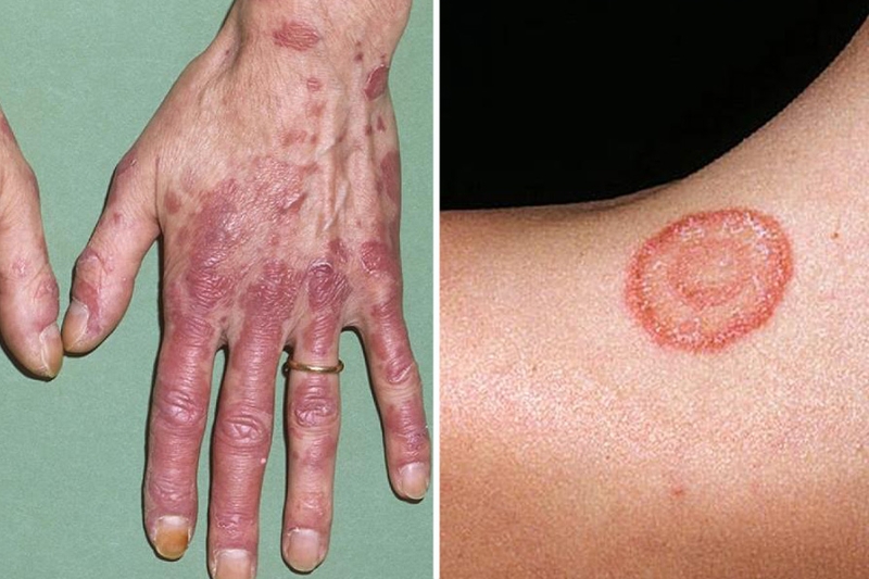 Rau má có mấy loại? Ăn như thế nào thì tốt? 4