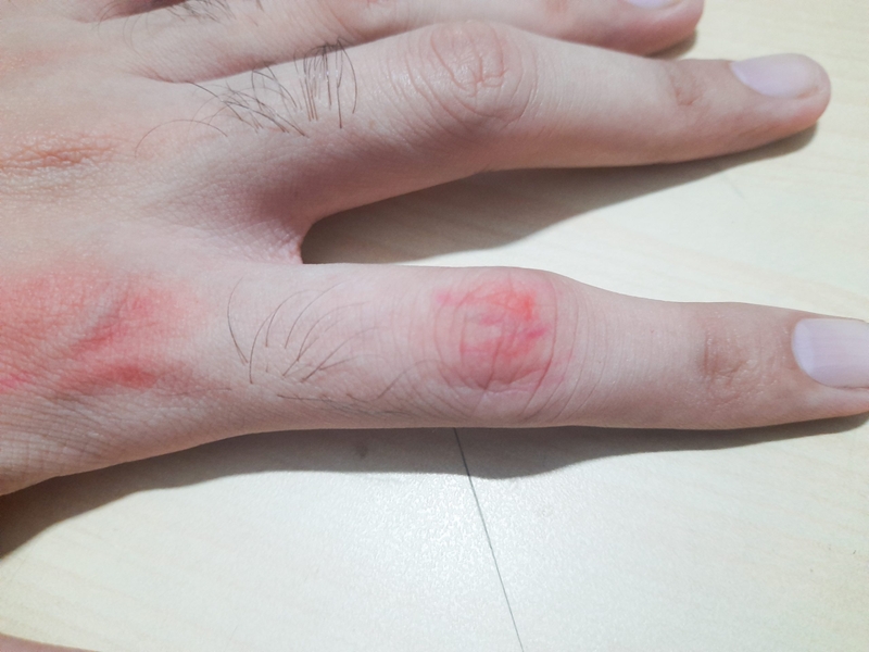 Rau mít rừng là rau gì? Thành phần dinh dưỡng và lợi ích sức khỏe 4