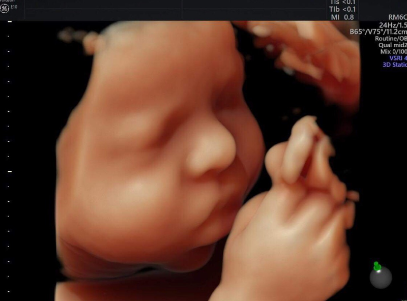 Sự phát triển của kích thước phôi thai theo tuần như thế nào? 3