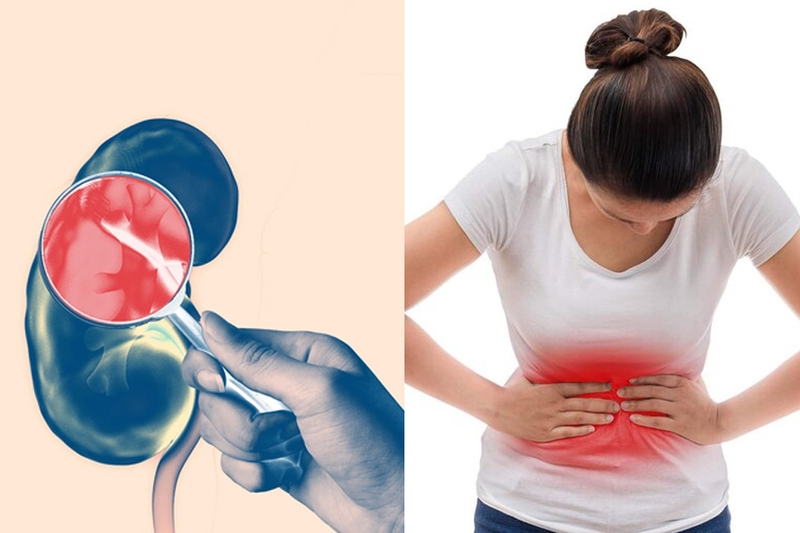 bai-viet/suy-than-do-3-co-phai-chay-than-khong-che-do-an-kieng-cho-benh-nhan-suy-than-giai-doan-3.html 1