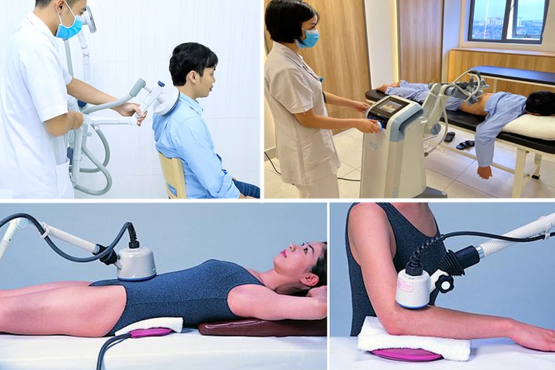 Tác dụng của sóng ngắn trị liệu? Ai nên và không nên áp dụng phương pháp này? 1