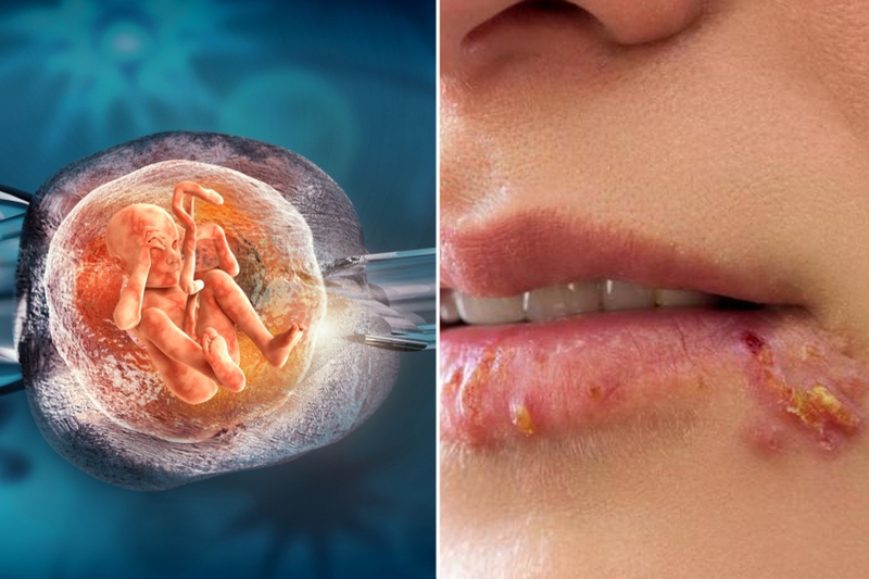 Thai ngoài tử cung đoạn kẽ là gì? Phương pháp chẩn đoán và điều trị 2