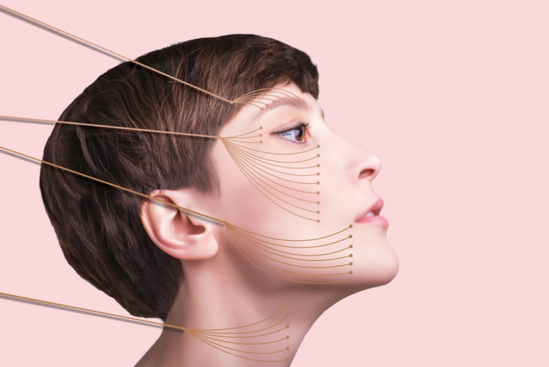 Thread lift: Phương pháp cấy chỉ thẩm mỹ để căng da mặt 1