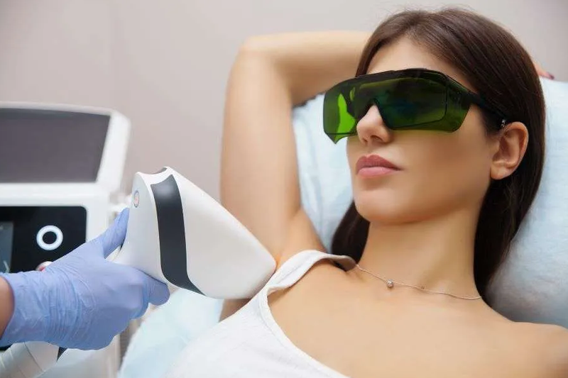 Triệt lông nách bao nhiêu lần thì hết? Cách chăm sóc da sau khi triệt lông? 1