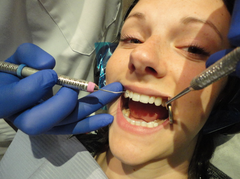 Trồng răng Implant có ăn được thịt gà không? Những lưu ý quan trọng khi ăn thịt gà sau cấy ghép 4