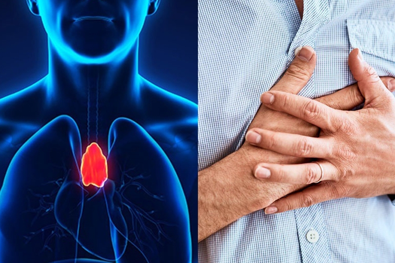 U trung thất ác tính sống được bao lâu? Cách điều trị và phòng ngừa 1