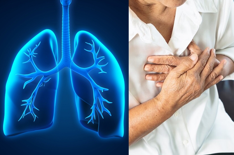 U trung thất ác tính sống được bao lâu? Cách điều trị và phòng ngừa 3