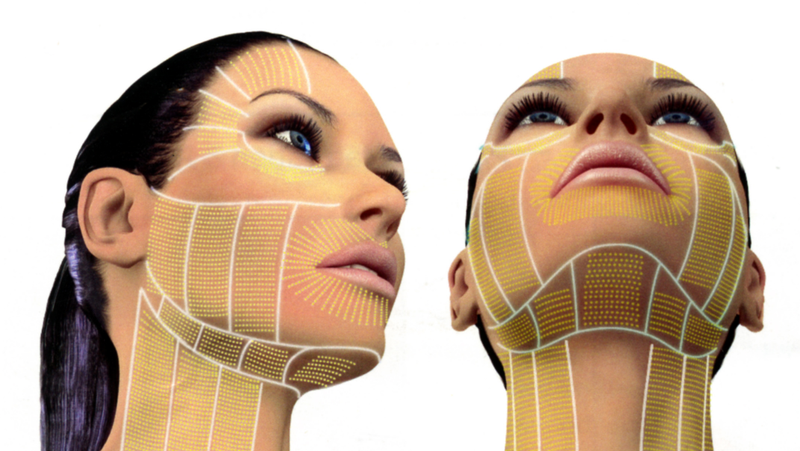 Ultherapy: Công nghệ nâng cơ, căng da, trẻ hóa da không xâm lấn 3