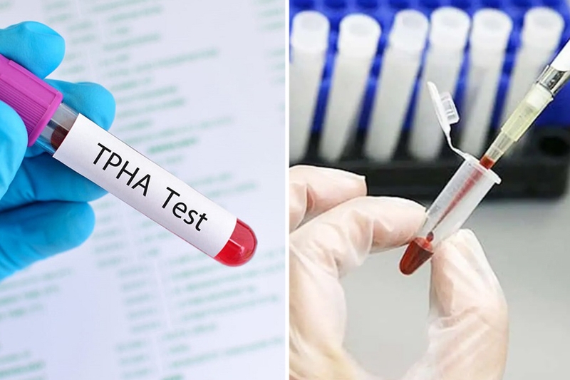 Xét nghiệm giang mai bao nhiêu tiền? Có được hưởng bảo hiểm y tế không? 3