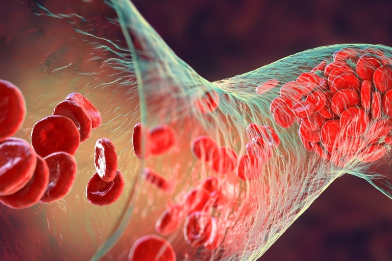 Xét nghiệm huyết đồ là gì? Vì sao phải làm xét nghiệm huyết đồ? 4