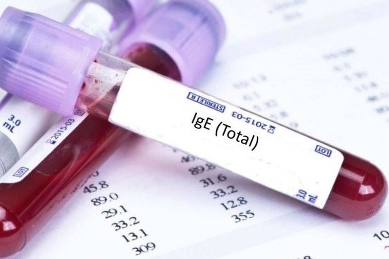 xet-nghiem-ig-e-la-gi-khi-nao-lam-xet-nghiem-ig-e 3