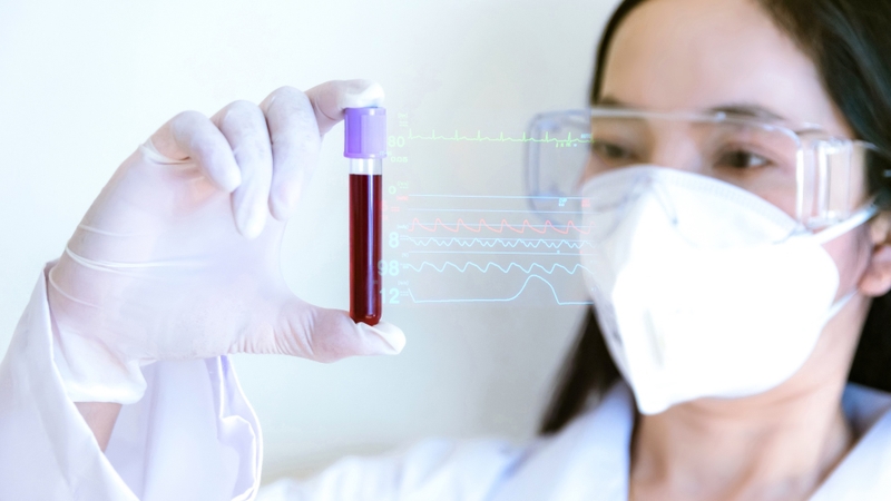 Khi nào cần xét nghiệm ký sinh trùng?