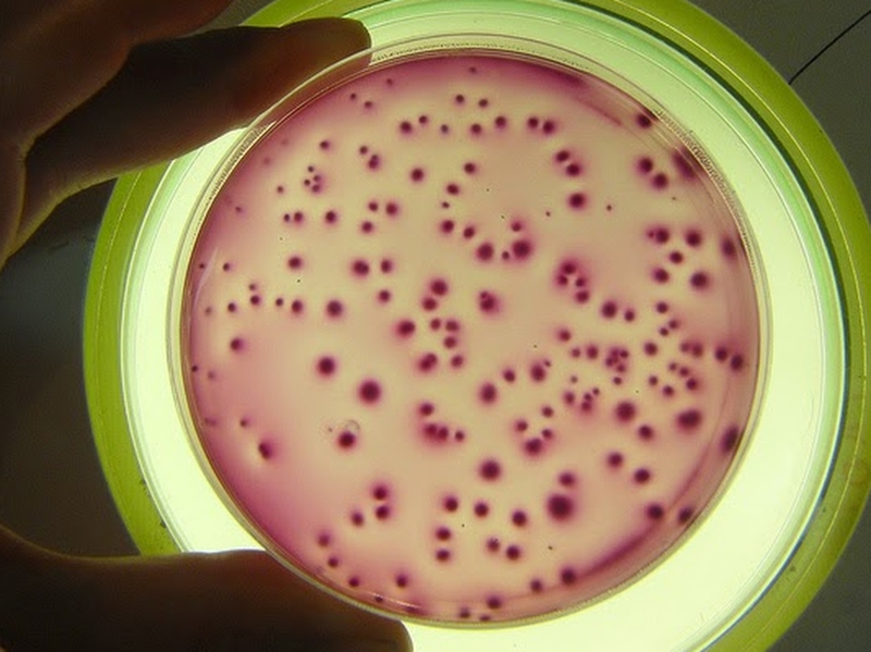 Xét nghiệm vi sinh là gì? Vì sao phải làm xét nghiệm vi sinh? 5