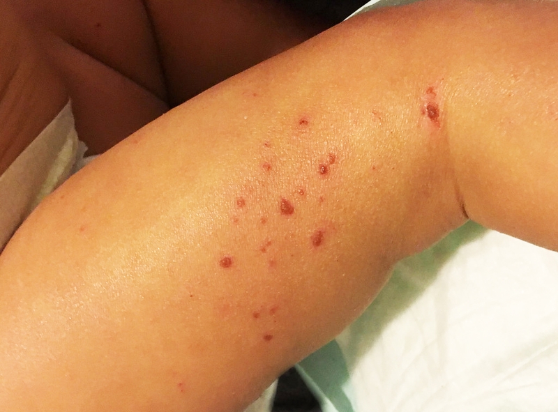 Xông lá ngải cứu có tác dụng gì? Cách xông ngải cứu tốt cho sức khỏe và sắc đẹp 6