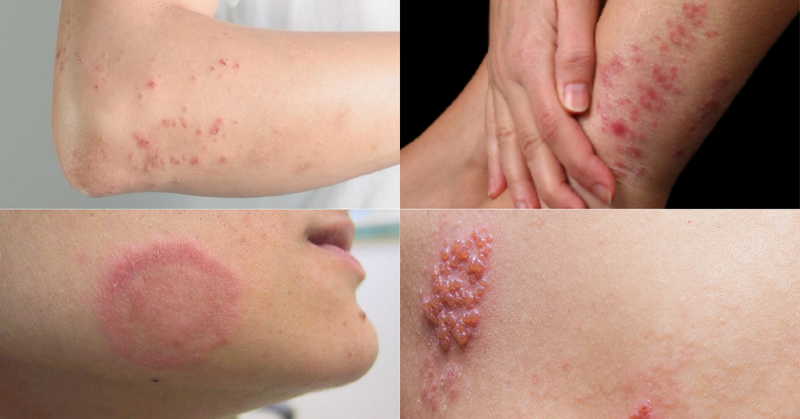 Baifem K có dùng được cho trẻ sơ sinh không? Những điều cần biết 3