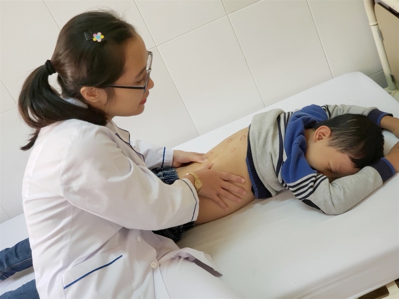 Bấm huyệt chữa chậm nói có đem lại hiệu quả? 3