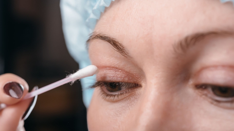 Bấm mí mắt có đau không, có để lại sẹo hay không? 1