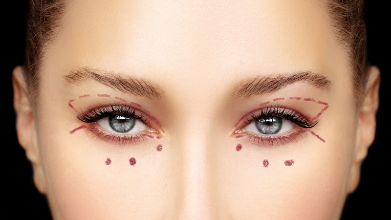 Bấm mí mắt có đau không, có để lại sẹo hay không? 2