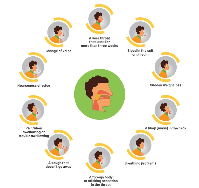 Bạn biết gì về các giai đoạn ung thư thanh quản? 2