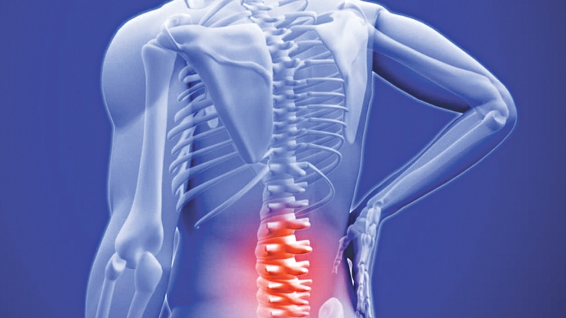 Bạn biết gì về loãng xương độ 3? 2