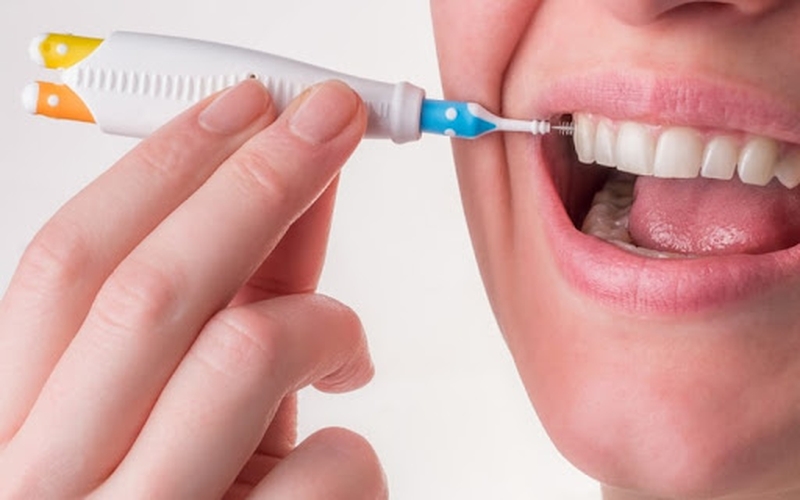 Bàn chải kẽ răng giúp loại bỏ mảng bám dễ dàng