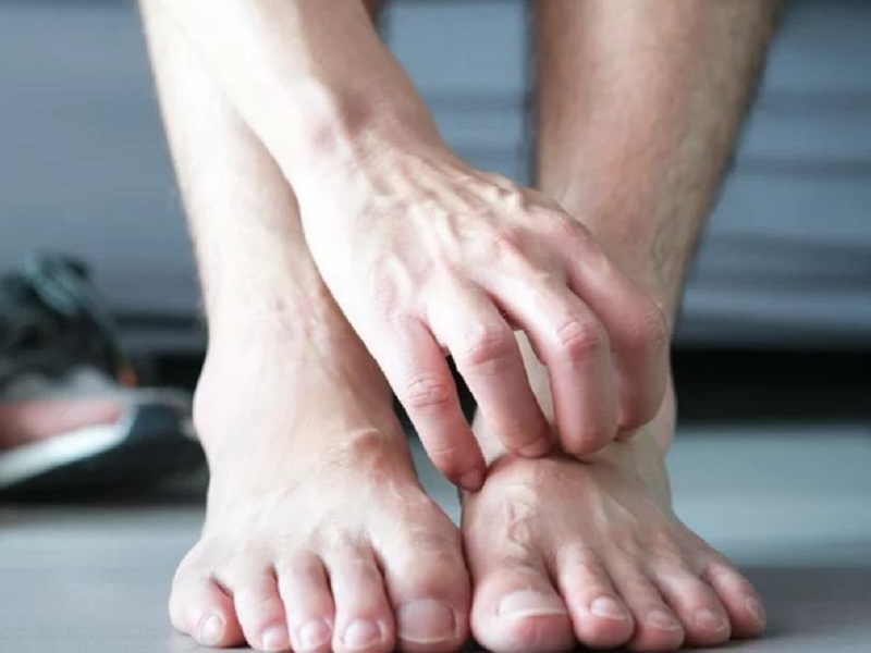 Bàn chân nói lên điều gì ở sức khỏe của bạn? 3