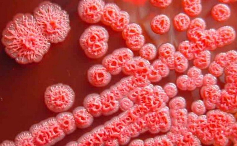 Bạn đã biết bệnh Whitmore là gì chưa?