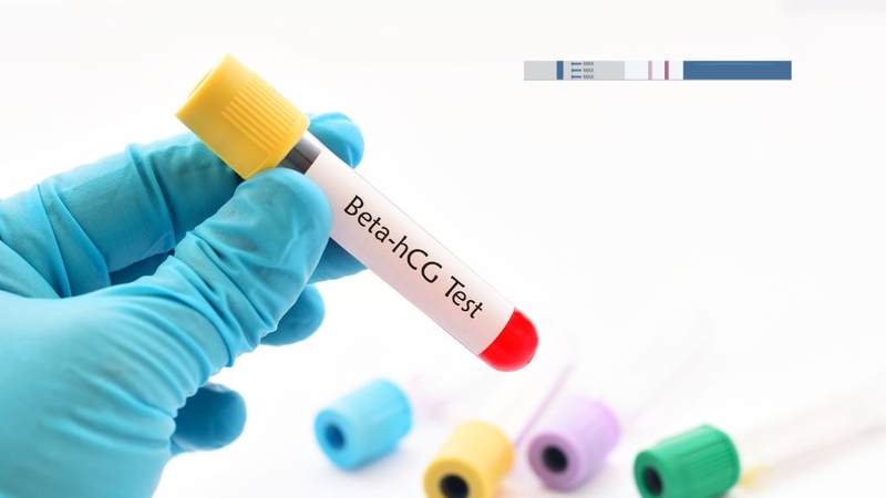 ban-co-biet-cach-doc-ket-qua-xet-nghiem-beta-h-cg-dung-cach-chua 3