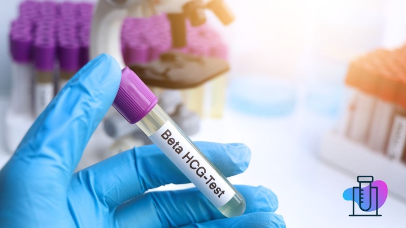 ban-co-biet-cach-doc-ket-qua-xet-nghiem-beta-h-cg-dung-cach-chua 4