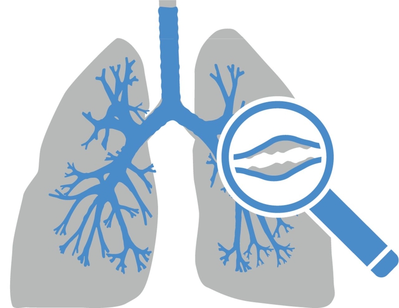 Bạn có biết: Người bị lao phổi sống được bao lâu  3
