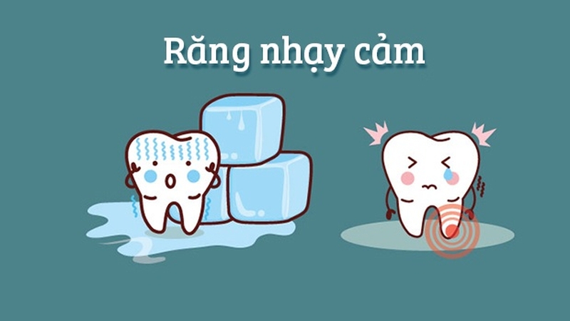 Kem đánh răng Sensodyne rất thích hợp với răng nhạy cảm