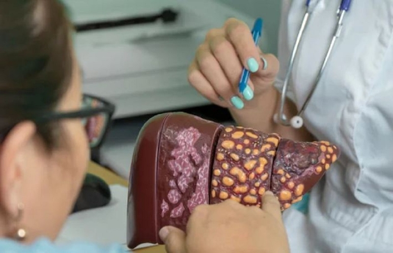 Bạn có biết những người bị bệnh viêm gan A thường có triệu chứng gì? 2