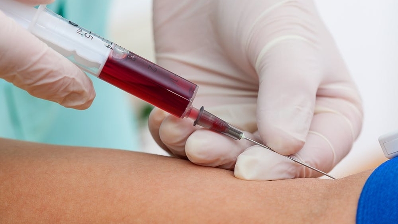 Bạn có biết: Uống rượu sau bao lâu thì xét nghiệm máu được? 4