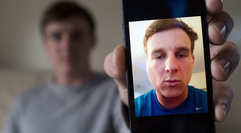 Bạn đã biết bệnh nhân mắc quai bị khi nào hết sưng chưa 1