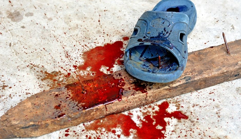 Bạn đã biết gì về bệnh uốn ván và cách phòng ngừa hiệu quả 2