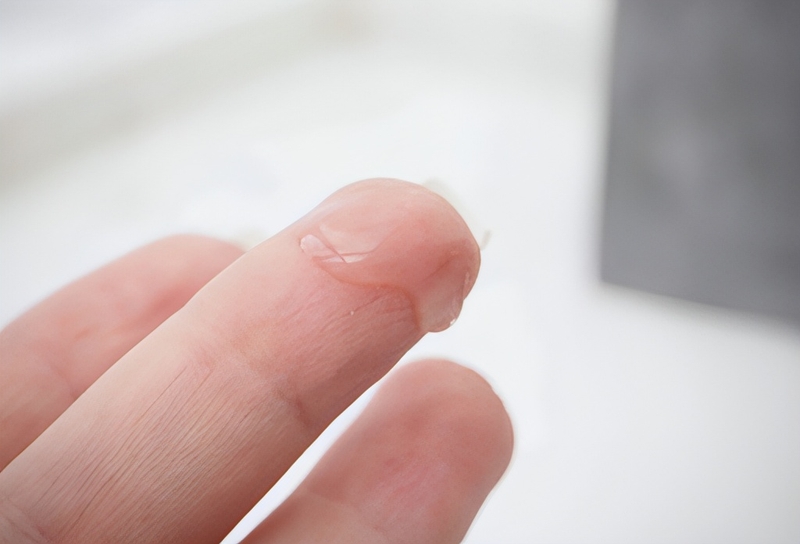 Tinh trùng thấp có thể là nguyên nhân gây vô sinh ở nam giới