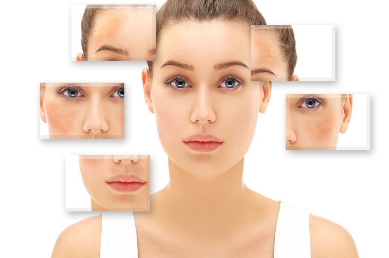 Bắn tàn nhang bao nhiêu tiền? Quy trình thực hiện bắn tàn nhang 2