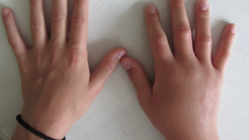 ban-tay-bi-sung-nguyen-nhan-va-cach-xu-tri 2