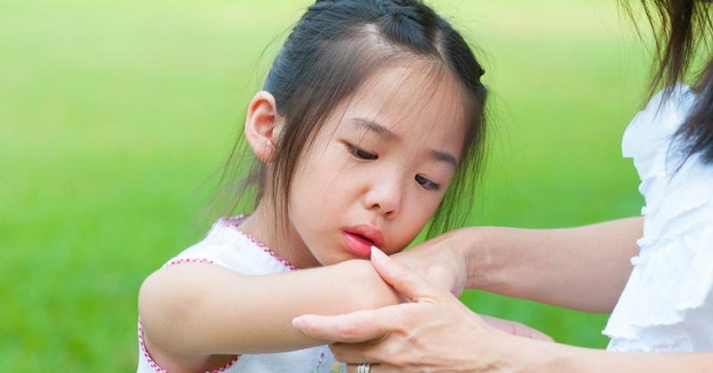 Bán trật đài quay là gì? Phương pháp điều trị và một số lưu ý phụ huynh cần nắm rõ 2