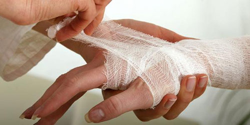 Sơ cứu bỏng sai cách là sai lầm hay gặp phải của nhiều người 2