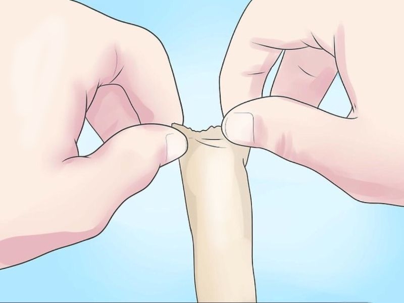 Bảng giá cắt bao quy đầu bao nhiêu 1