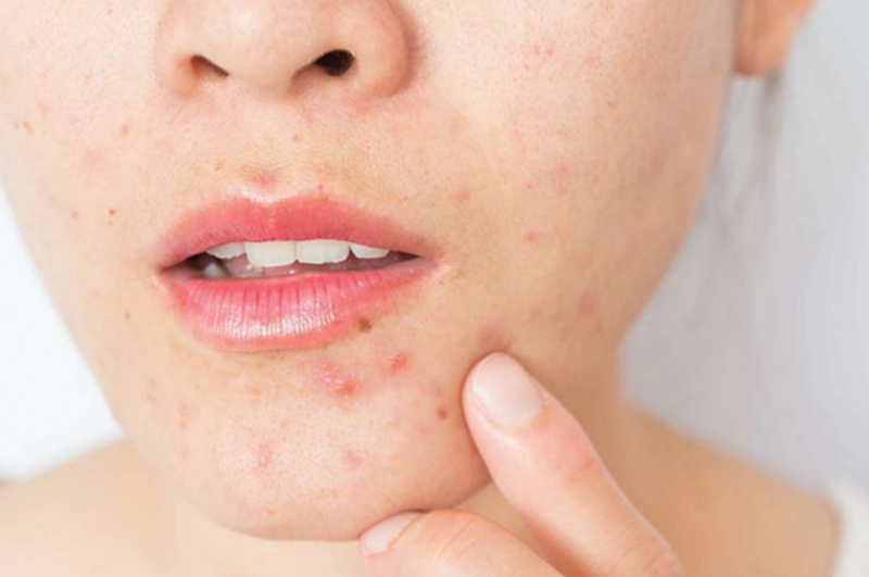 Bánh Karo bao nhiêu calo 3