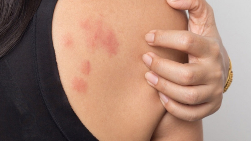 Bantet là thuốc gì? Những điều cần lưu ý khi sử dụng thuốc Bantet 2