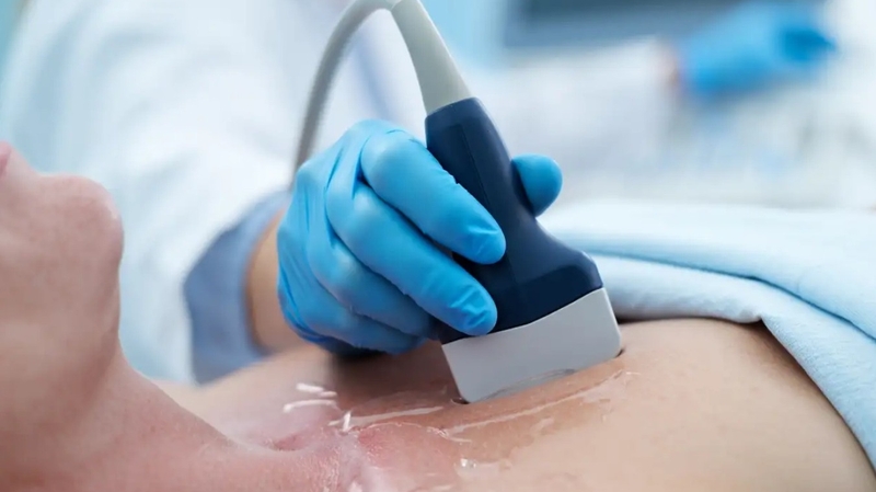 Bao lâu siêu âm tim 1 lần phụ thuộc vào tình trạng sức khỏe, bệnh lý, triệu chứng,...