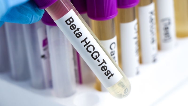 Hiện nay có thể xác định được bao lâu thì phát hiện thai trứng thông qua xét nghiệm β-hCG